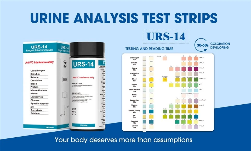 Urinalysis Reagent Rapid Test manufacturers